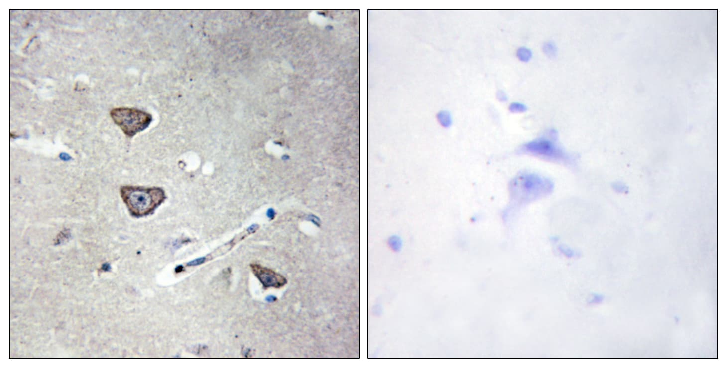 Polyclonal Rabbit anti-Human HTR2C / 5-HT2C Receptor Antibody (aa161-210, IHC, IF)