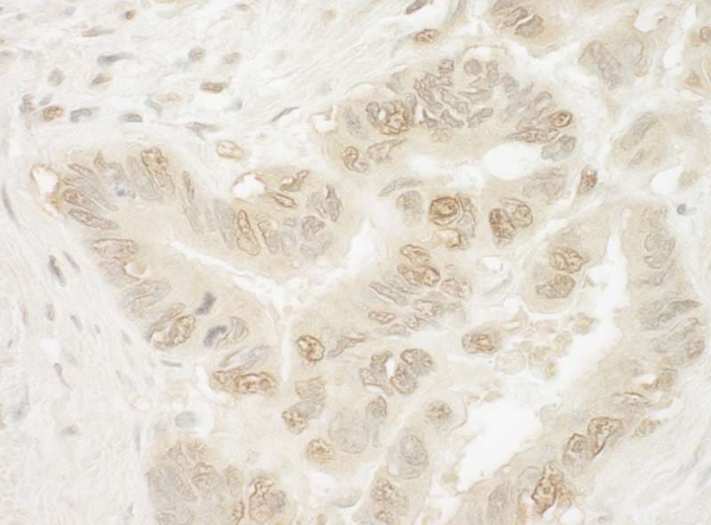 Polyclonal Rabbit anti-Human PYGO1 / Pygopus 1 Antibody (aa300-350, IHC)