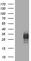 Monoclonal Mouse anti-Human CD99 Antibody (clone OTI1F11, IHC, WB)