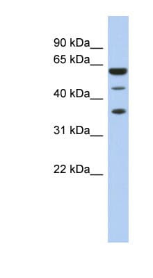 Polyclonal Rabbit anti-Human NELFE / RD / RDBP Antibody (aa35-84, WB)