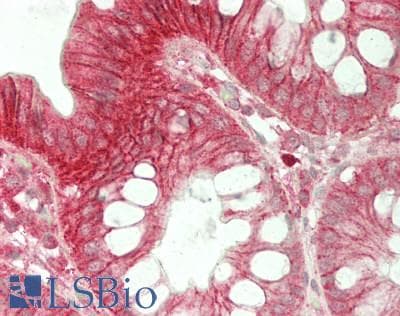 IHC-plus™ Polyclonal Rabbit anti-Human ST14 / Matriptase Antibody (aa800-C-term, IHC, WB)