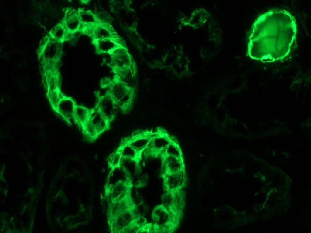 PathPlus™ Monoclonal Mouse anti-Human KRT7 / CK7 / Cytokeratin 7 Antibody (clone OVTL12/30, IHC, WB)