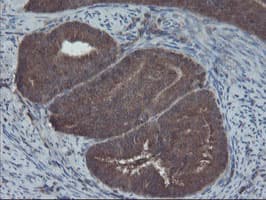 COMMD1 Antibody (clone OTI1F2)