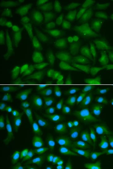 SORD / Sorbitol Dehydrogenase Antibody
