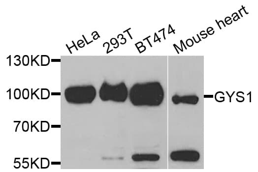 IHC-plus™ GYS1 / Glycogen Synthase Antibody
