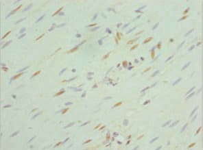 SEPHS1 / SPS Antibody