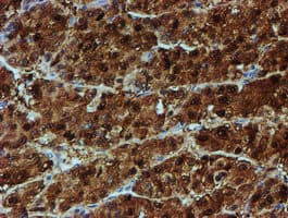 NQO2 Antibody (clone OTI3G4)