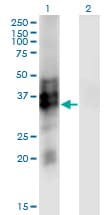 SYP / Synaptophysin Antibody (clone 3B3)
