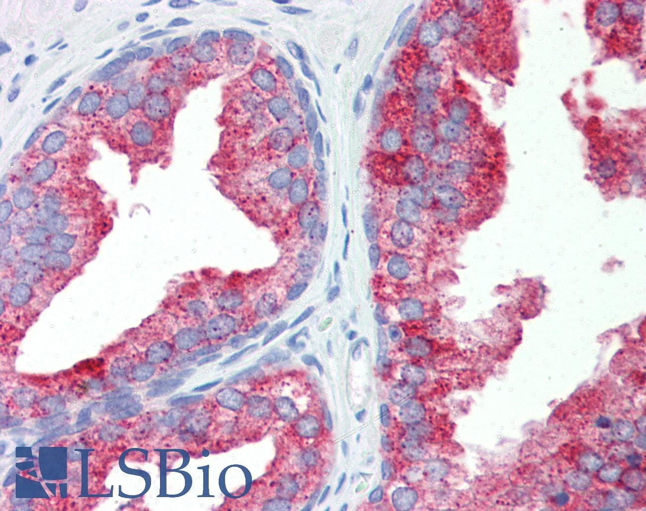 NR1I3 / CAR Antibody (aa180-229)