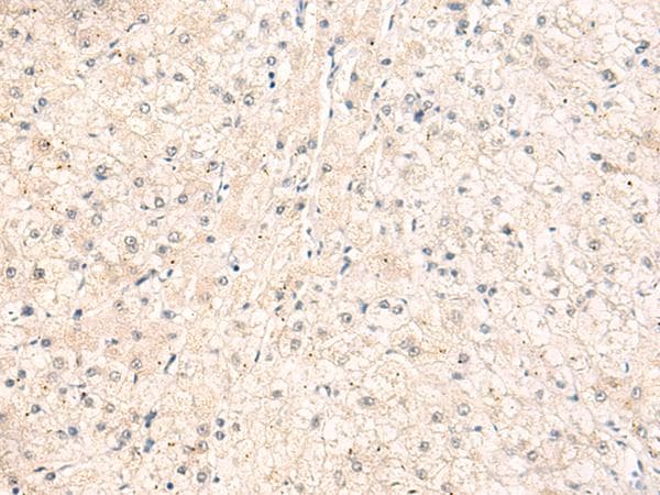 Polyclonal Rabbit anti-Human IKBKAP / IKAP Antibody (IHC)