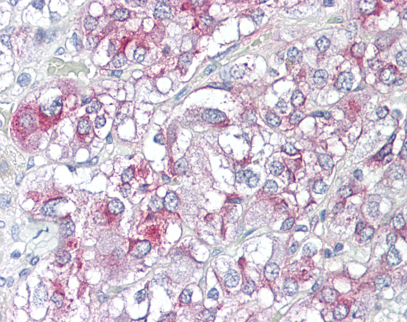 KCNH3 / Kv12.2 Antibody (aa684-733)