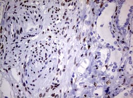 ZEB2 / SIP-1 Antibody (aa1-350, clone OTI1E12)