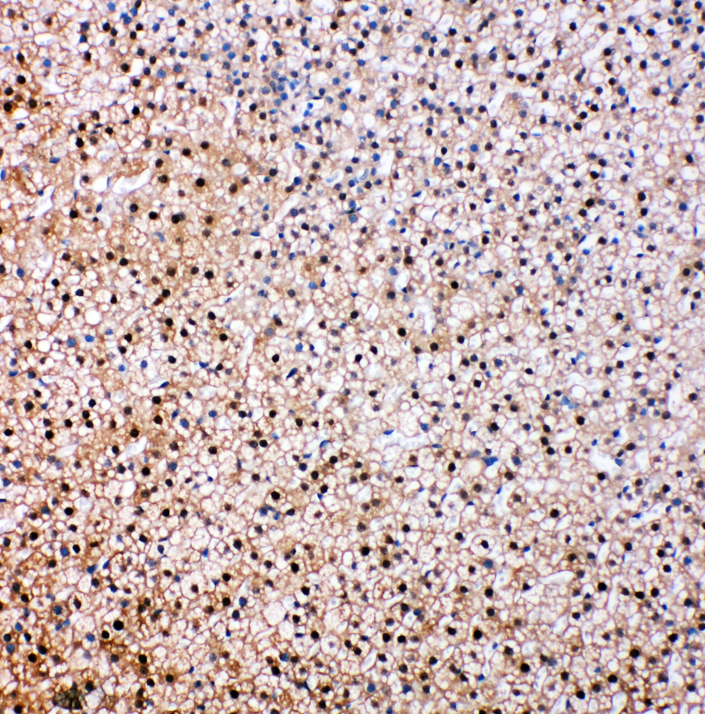 Polyclonal Rabbit anti-Human VCP Antibody (aa749-766, IHC, WB)