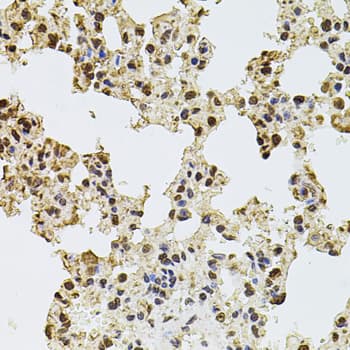 Polyclonal Rabbit anti-Human ZNF408 / PRDM17 Antibody (IHC, WB)