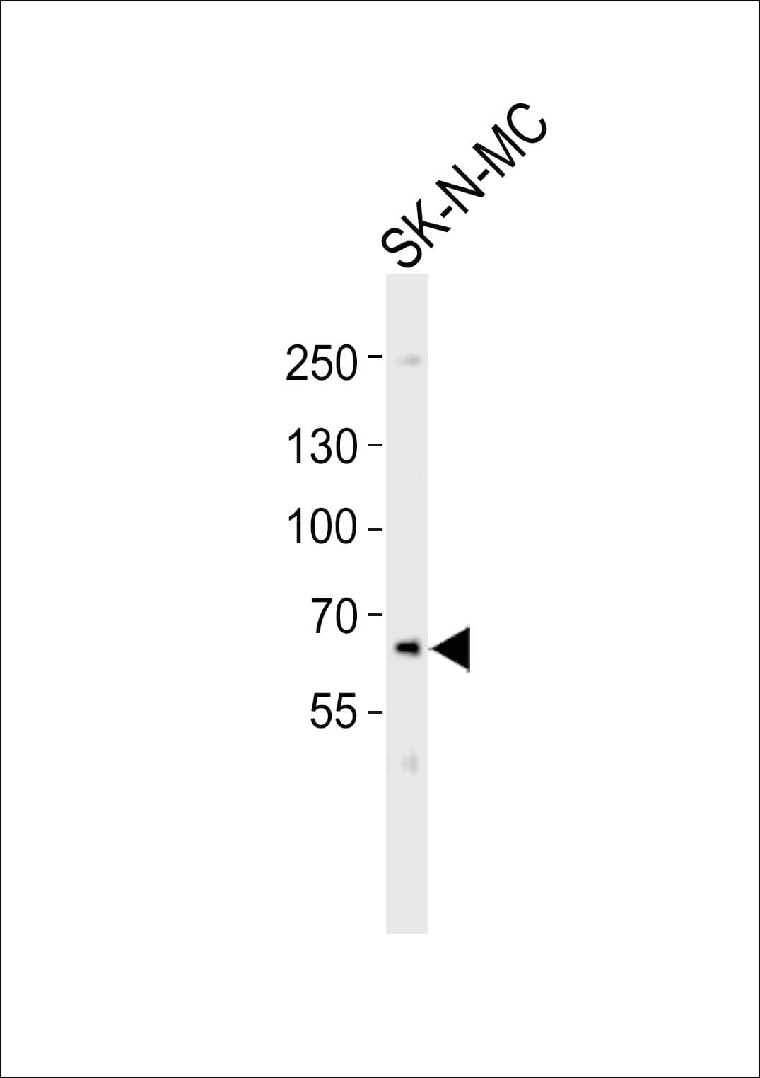Polyclonal Rabbit anti-Human PCSK9 Antibody (aa654-688, WB)