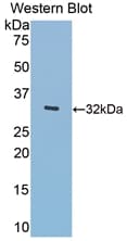 Beta-N-Acetylglucosaminidase Antibody (aa319-450)