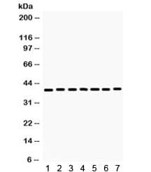 HDAC11 Antibody