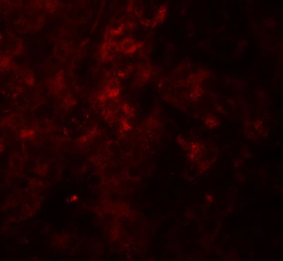 Polyclonal Rabbit anti-Human SESN2 / HI95 Antibody (IHC, IF, WB)