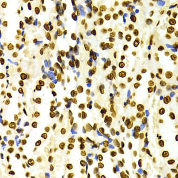 Histone H3 Antibody (Dimethyl-Lys27)
