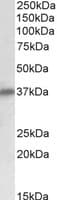 IHC-plus™ Polyclonal Goat anti-Human SGCD / Delta-Sarcoglycan Antibody (aa244-256, IHC, WB)