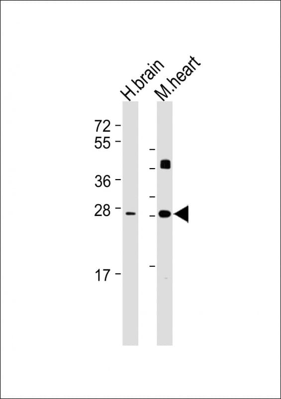 DKK2 Antibody (clone 1833CT856.7.20)