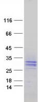 Human SIT1 Protein (Recombinant Myc-DDK (Flag))