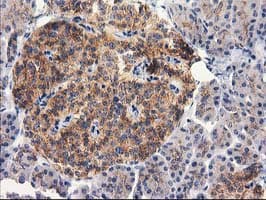 RTN4IP1 / NIMP Antibody (clone OTI3B2)