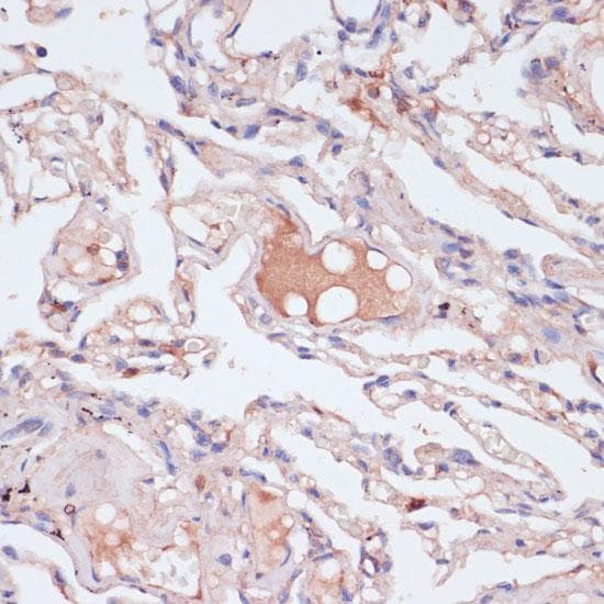 Polyclonal Rabbit anti-Human IFN Gamma / Interferon Gamma Antibody (IHC)