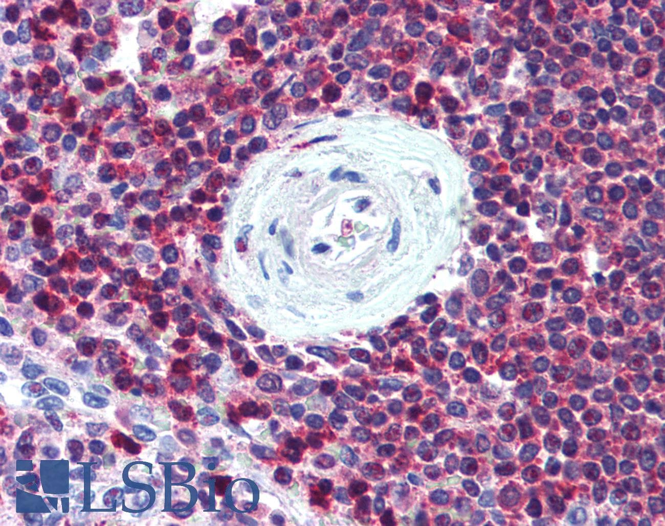 IHC-plus™ SLC9A3R1 / NHERF1 / EBP50 Antibody