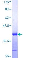 Human CALCOCO2 Protein (Recombinant GST, N-terminus)