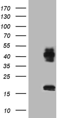 L3 / LASS2 Antibody (aa62-136, clone OTI3D9)