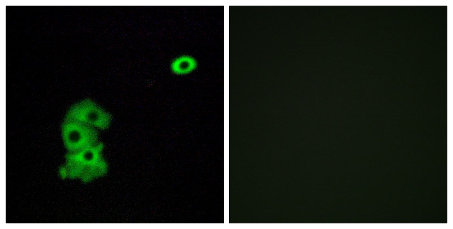 OR4C6 Antibody (aa193-242)