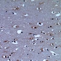 TPH2 Antibody