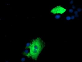ZFP36 / Tristetraprolin Antibody (clone OTI1F2)