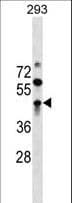 Polyclonal Rabbit anti-Human ZBTB32 / TZFP Antibody (aa96-125, WB)