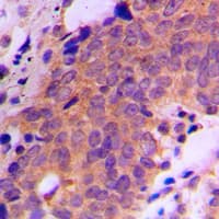 Polyclonal Rabbit anti-Human USP19 Antibody (aa400-439, IHC, WB)