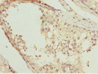 NR2E1 / TLX Antibody