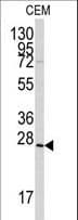 GREM1 / Gremlin-1 Antibody (aa147-175)