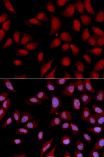 HURP / DLGAP5 Antibody