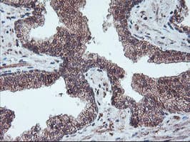 Monoclonal Mouse anti-Human PPP1R15A / GADD34 Antibody (clone OTI4F1, IHC, IF, WB)