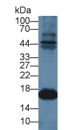 MB / Myoglobin Antibody (aa1-154, APC)