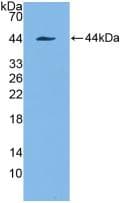 KRT7 / CK7 / Cytokeratin 7 Antibody (aa91-394)