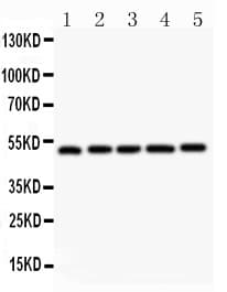 NR1H3 / LXR Alpha Antibody (aa371-385)