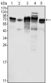 MTDH / Metadherin Antibody (clone 2F11C3)
