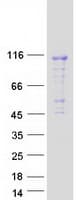 Human DENND1C Protein (Recombinant Myc-DDK (Flag))