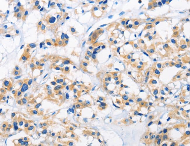 Polyclonal Rabbit anti-Human HK1 / Hexokinase 1 Antibody (IHC)