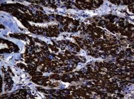 HSPD1 / HSP60 Antibody (clone OTI3G1)