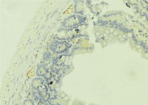 DHRS9 Antibody
