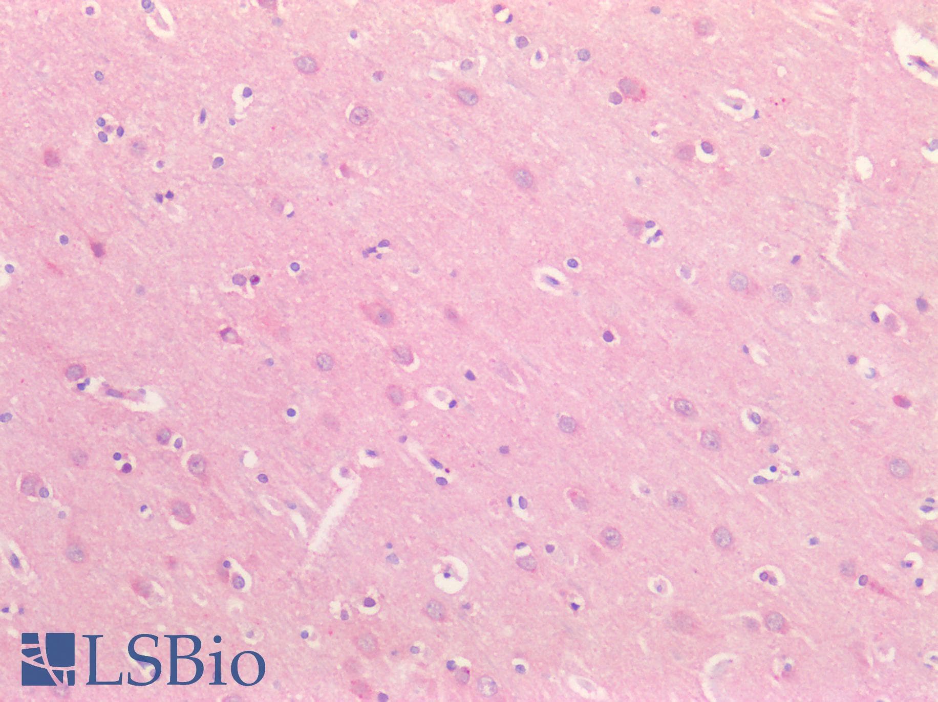 PathPlus™ Polyclonal Rabbit anti-Human SMC1A / SMC1 Antibody (aa1-248, IHC, WB)