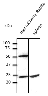 IHC-plus™ RAB8A / RAB8 Antibody (C-Terminus)